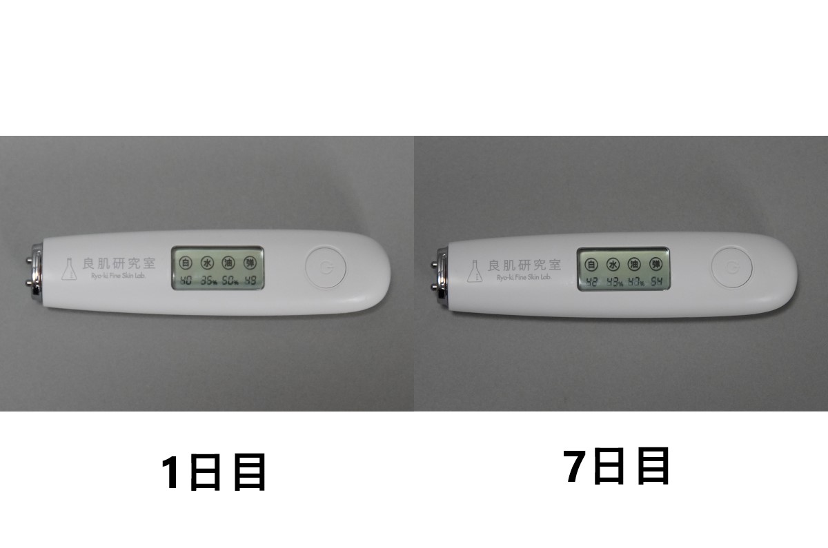 簡易肌分析器の画像